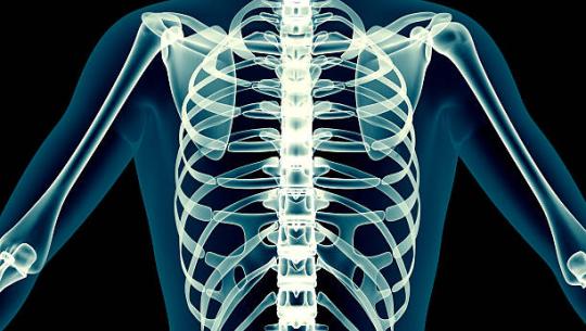Skeleton Xray