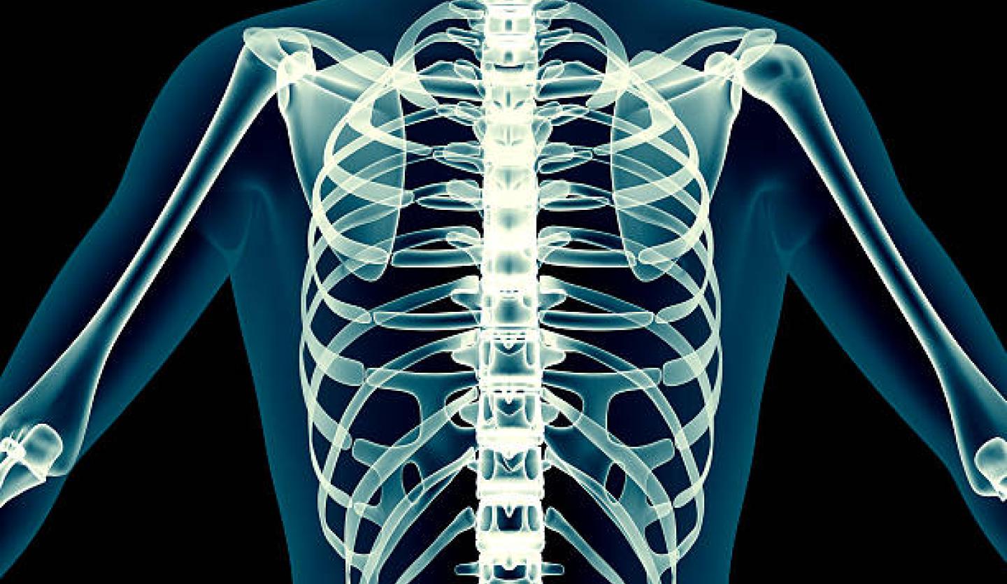 Skeleton Xray