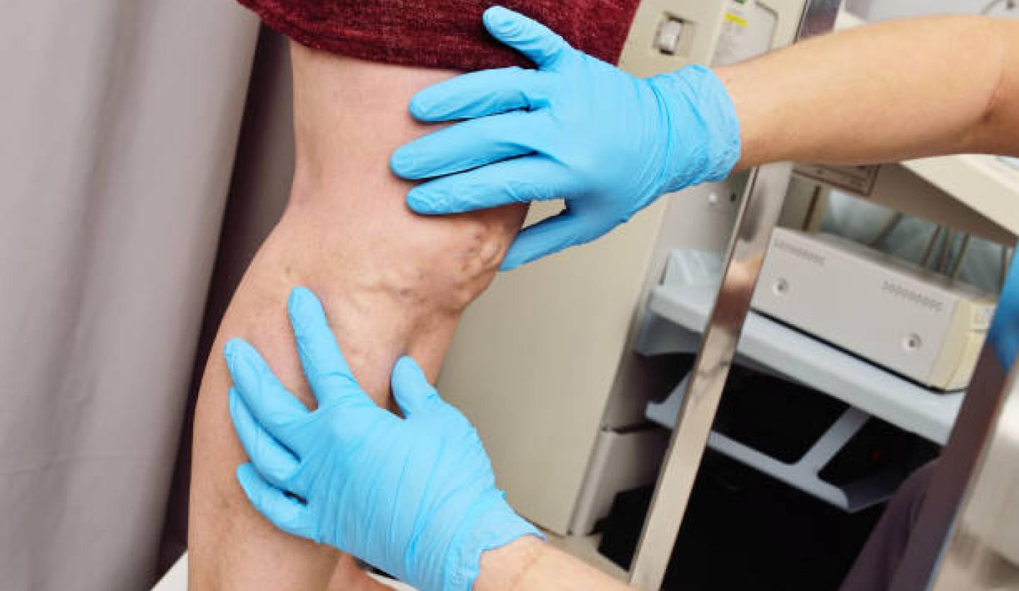 Veins