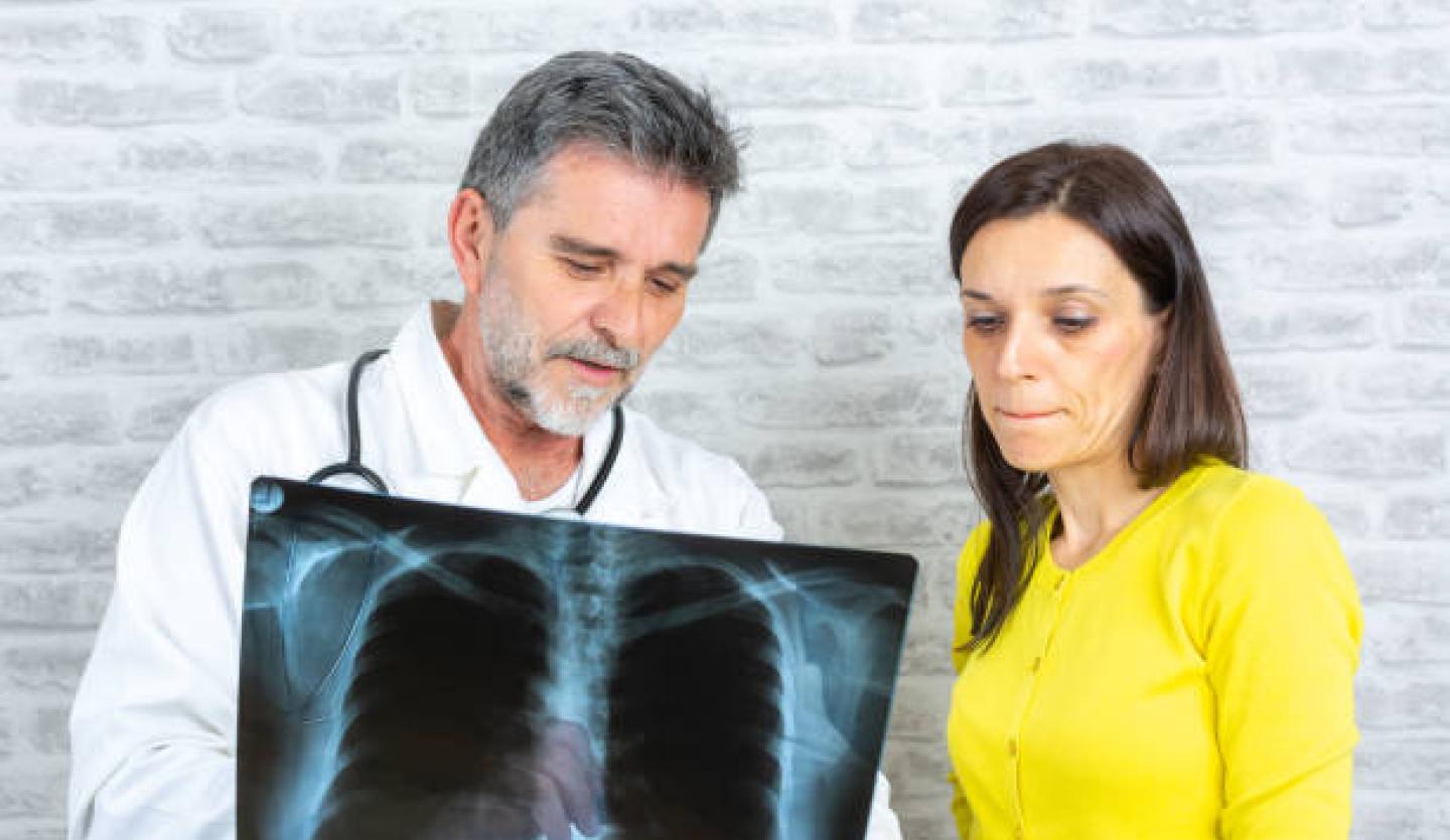 lung cancer screening