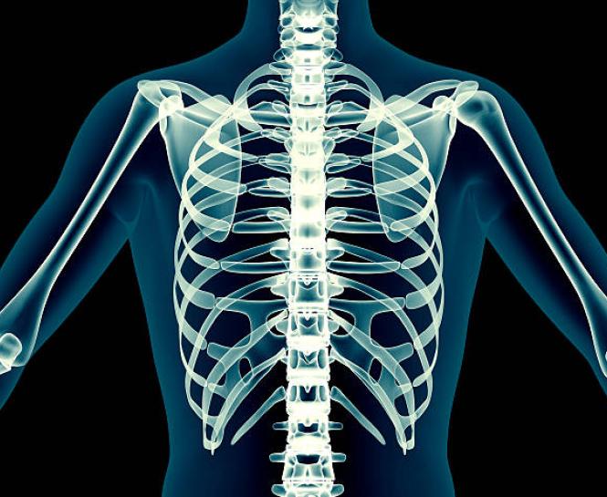 Skeleton Xray