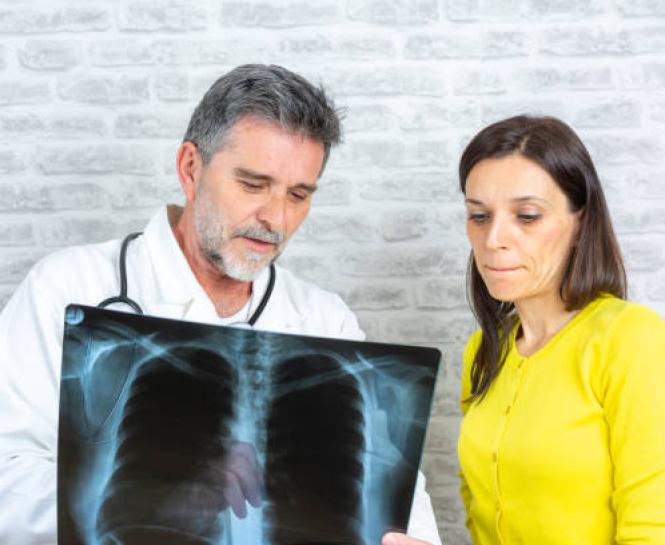 lung cancer screening