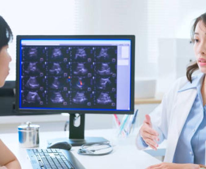 Colorectal Cancer
