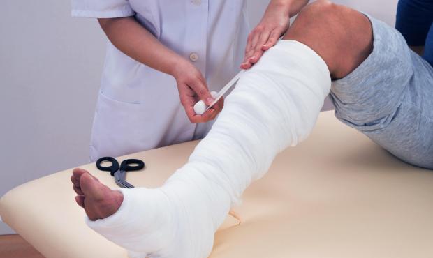 doctor putting cast on leg